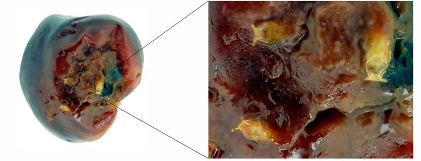 Pupas de Drosophila suzukii en una cereza